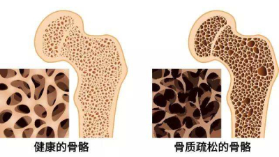 91免费版黄片儀