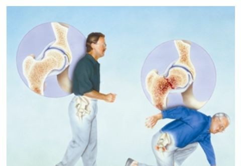 91免费版黄片檢測儀檢測骨質疏鬆的真麵目,91免费版黄片健康值