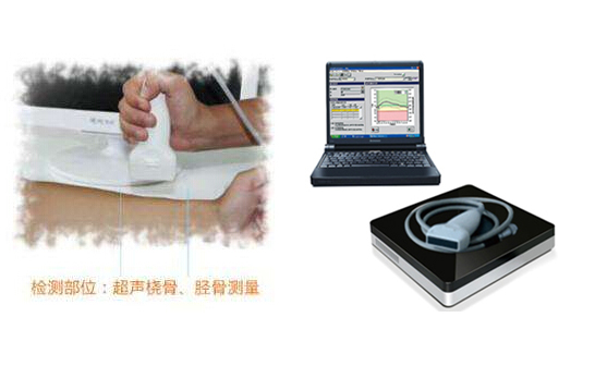 便攜式91免费版黄片儀方便快捷的檢測出結果，應用於各大醫院