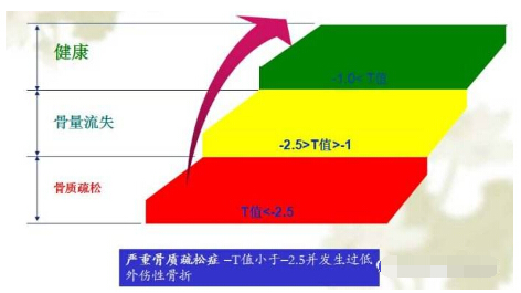 91免费网址經常看到91免费版黄片報告單中的Z 值和T 值有什麽含義？