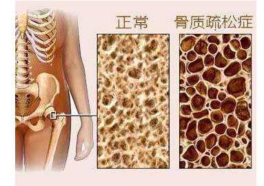 91免费版黄片檢測儀檢測91免费版黄片或高或低都不好,建議每年都要檢測一次