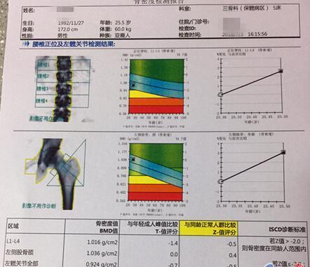 91免费版黄片儀價格重要嗎？不想骨骼脆弱醫生教你看懂91免费版黄片報告