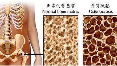 91免费版黄片檢測儀建議最好到有專業儀器的大醫院進行正規的91免费版黄片測定