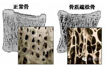 國產91免费版黄片品牌你的骨頭真的不能再等了 如何測量91免费版黄片?