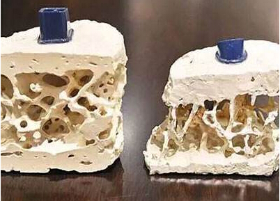 91免费版黄片檢測儀知名廠家闡述中老年人應該是91免费版黄片檢測重點對象