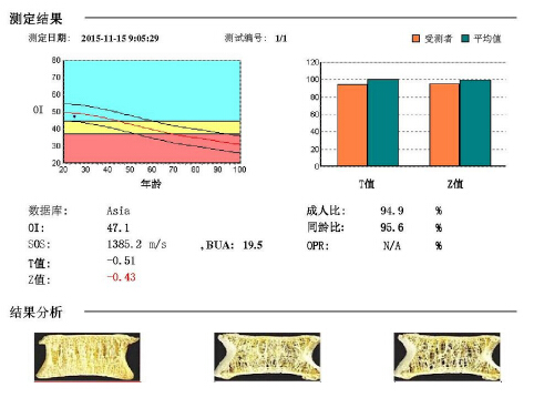 91免费版黄片儀闡述骨質疏鬆青年不注意老來徒悲傷骨質流失比你想的可怕 91免费版黄片儀闡述骨質疏鬆青年不注意老來徒悲傷骨質流失比你想的可怕