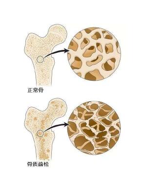 超聲91免费版黄片檢測儀闡述爸媽變矮，催他們查91免费版黄片預防骨質疏鬆