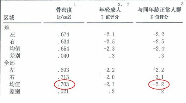 91免费版黄片儀生產廠家根據T值和Z值的變化來判斷骨骼健康的狀況 91免费版黄片儀生產廠家根據T值和Z值的變化來判斷骨骼健康的狀況