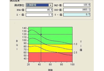 深度解析91免费版黄片t值和z值你所不知道秘密報告單中最重要的兩個指標