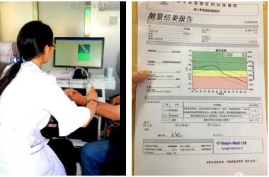 國產91免费版黄片儀能夠準確評估骨質狀態和可能發生骨折的風險早發現早治療