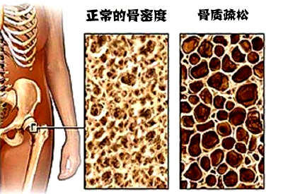 91免费版黄片儀品牌介紹市場上最常用的91免费版黄片設備看看哪種適合自己醫院采購