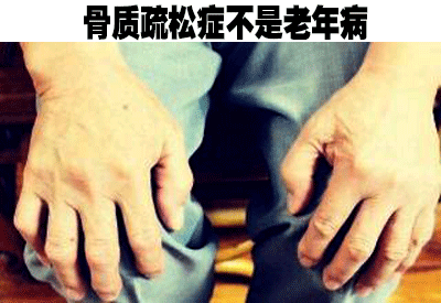 91免费版黄片儀品牌介紹人到中年不能失去“骨氣”骨質疏鬆症不是老年病