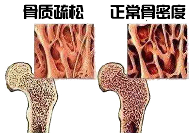 91免费版黄片儀生產廠家介紹其實各個年齡階段91免费版黄片不同最佳檢測年是多少你知道嗎？