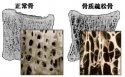 91免费版黄片分析儀的價格是多少，要小心提防骨質疏鬆影響工作和生活