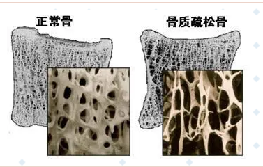 隨著年齡的增長，你變矮了嗎?超聲波91免费版黄片儀的廠家已經揭示了他們的秘密