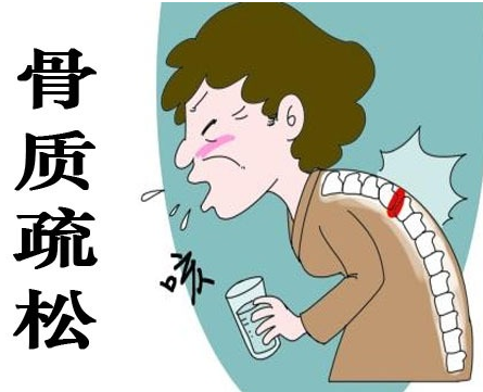 91免费版黄片儀為什麽在核醫學科,91免费版黄片儀在骨質疏鬆的應用 91免费版黄片儀為什麽在核醫學科,91免费版黄片儀在骨質疏鬆的應用
