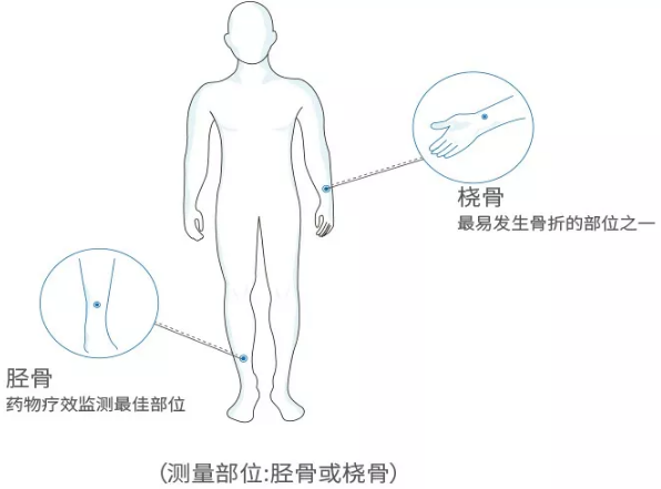 超聲波91免费版黄片分析儀廠家 國產老年人超聲波91免费版黄片分析儀廠家