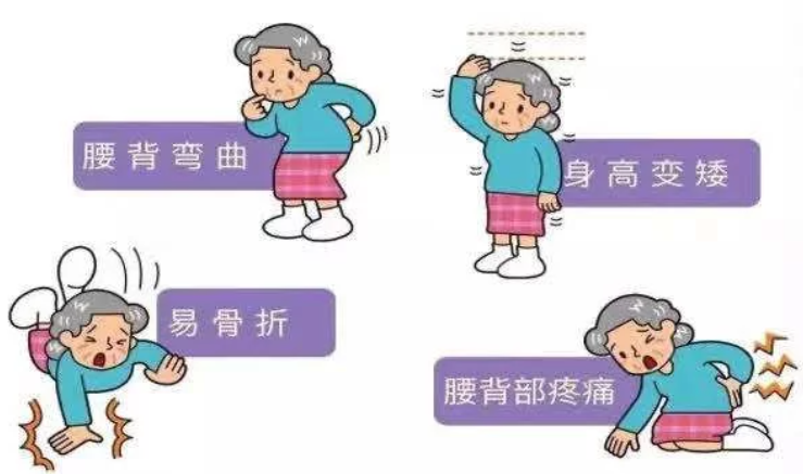 （遼寧沈陽）超聲91免费版黄片檢測分析儀警惕骨質疏鬆 91免费版黄片篩查也很重要！