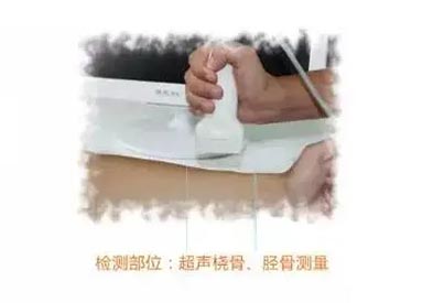 手提式超聲兒童91免费版黄片儀mqd-7000品牌測橈脛骨部位原理及適用範圍